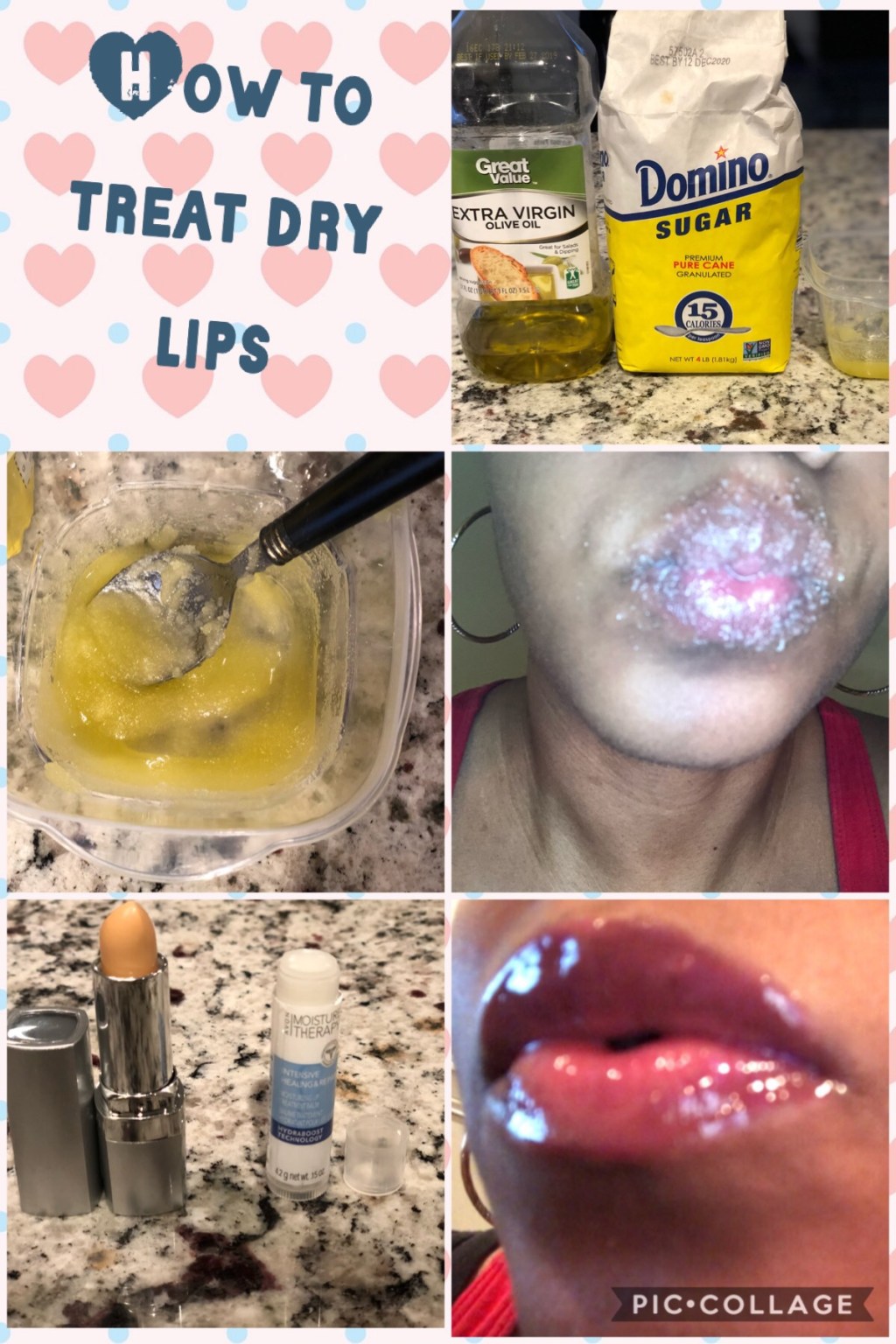 Dry Lips Remedy : How to Treat Dry Lips