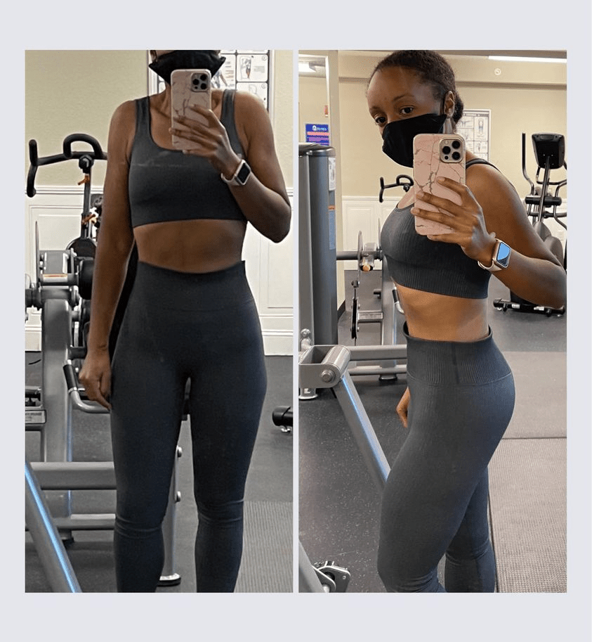 6 Ways to Prevent Loose Skin After Weight Loss